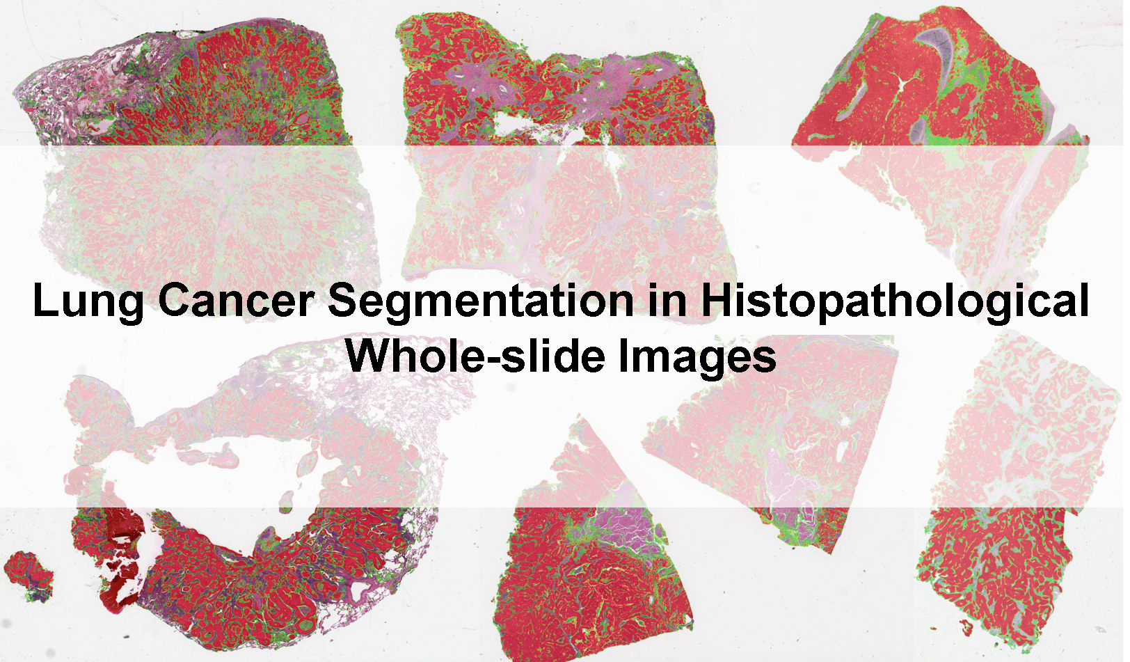 Logo for Lung Cancer Segmentation