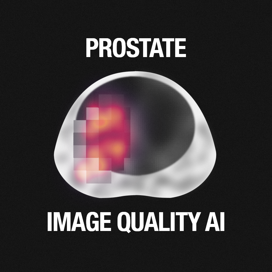 Logo for Deep Learning Image Quality for Prostate MRI