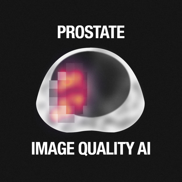 Deep Learning Image Quality for Prostate MRI Logo